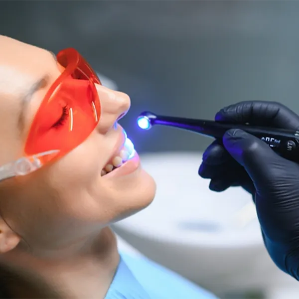 Funkcinis dantų plombavimas