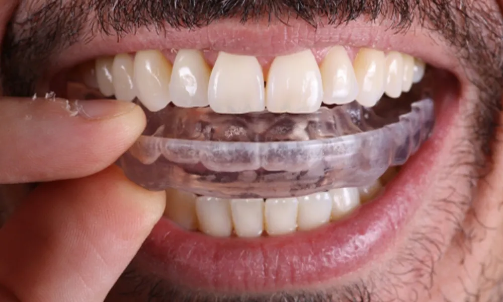 Dantų griežimo ir dilimo profilaktika, bruksizmo gydymas