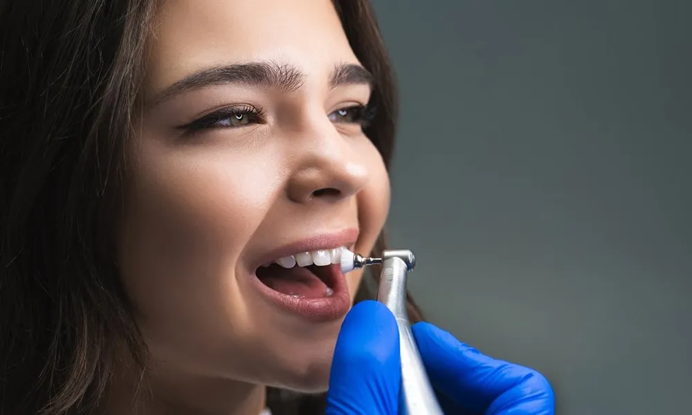 Profesionali burnos higiena