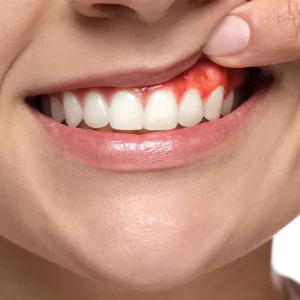 Periodontologinis gydymas